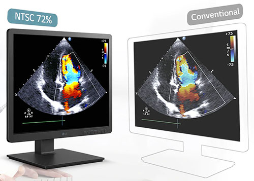 330nits & NTSC 72% Precise Resolution