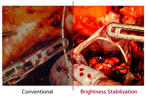 Brightness Stabilization