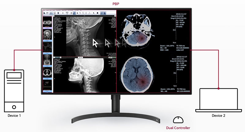 Multiple Signals on One Screen